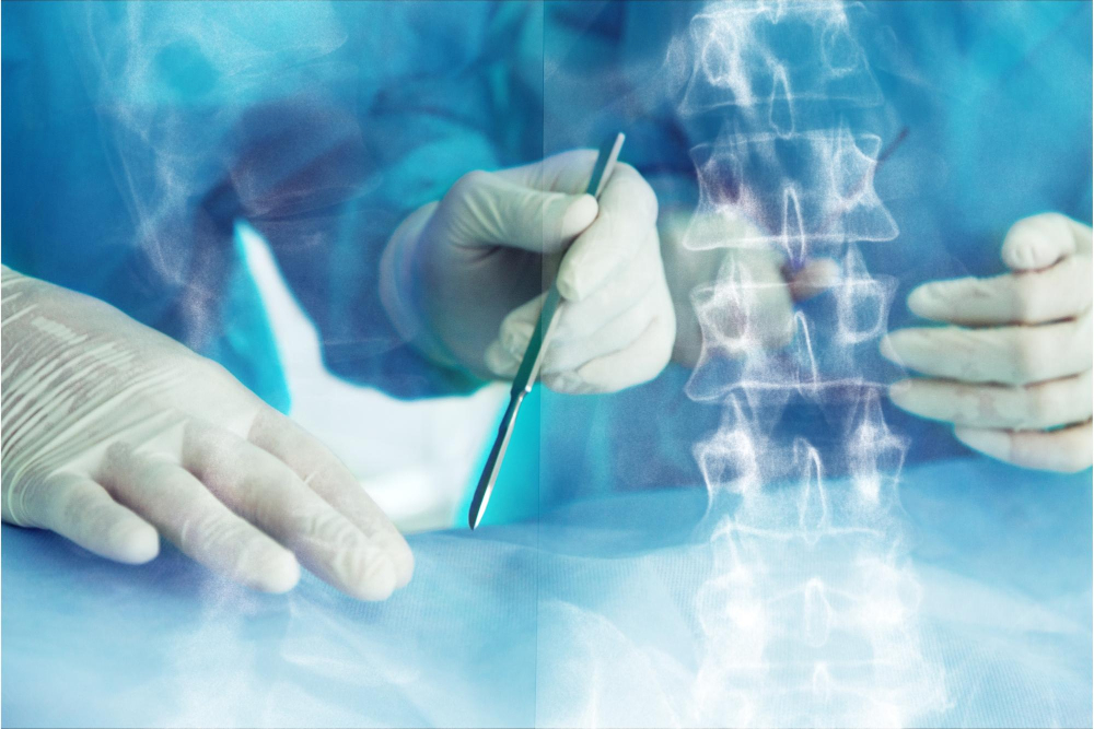 Neurosurgery and Spinal Surgery